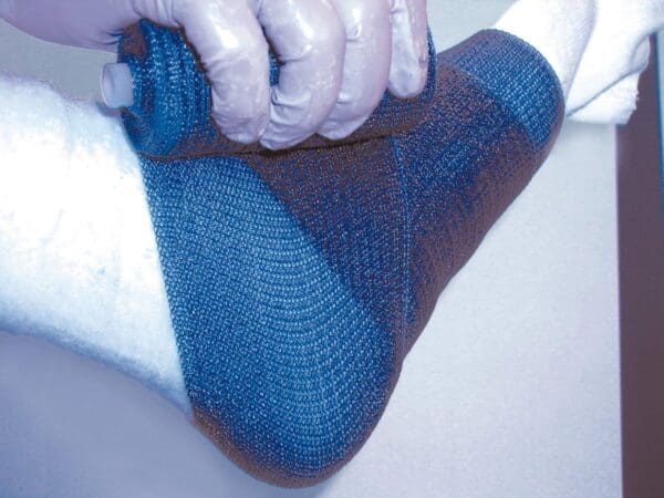 Delta-Lite® Plus Light Blue Cast Tape