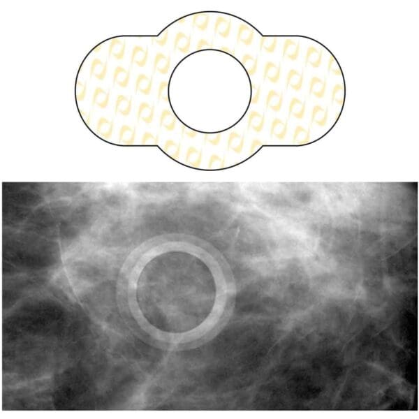 Spee-D-Ring™ Skin Marker